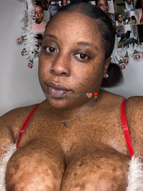 Freckledfantasy5