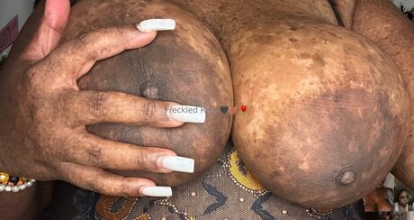 Freckledfantasy5