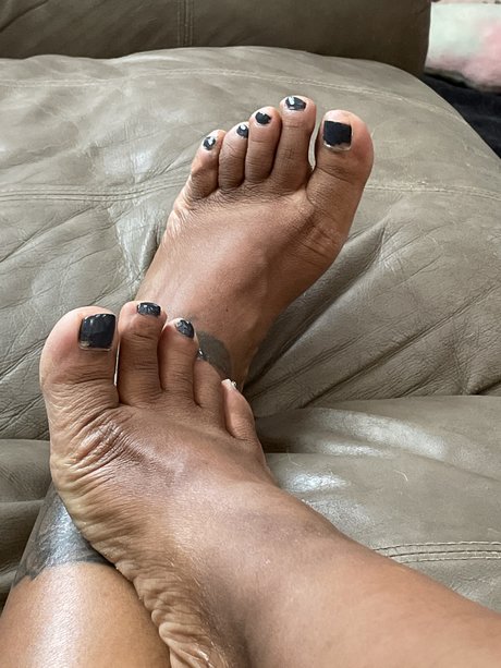 Ugly Feet