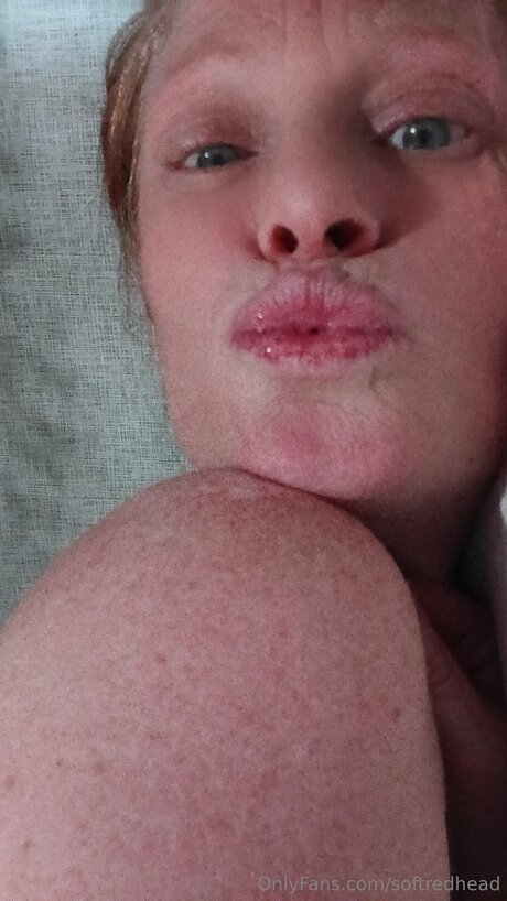 Softredhead