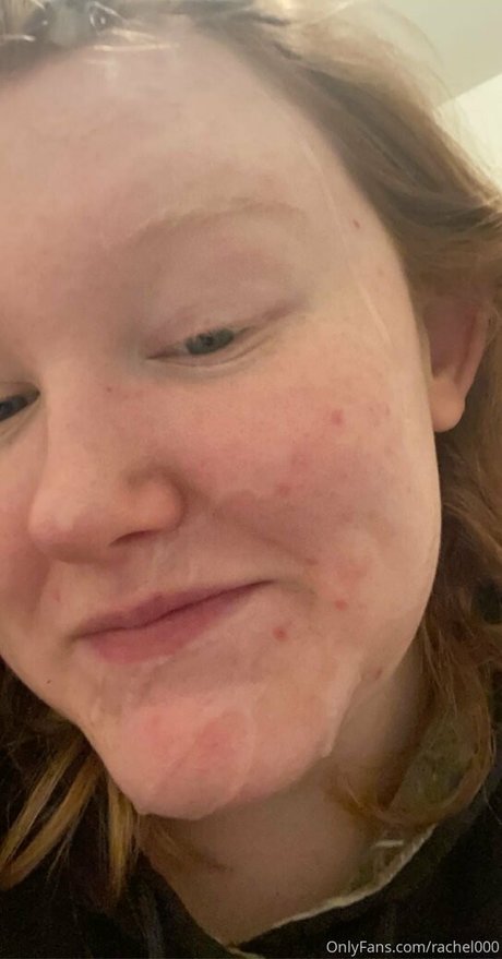 Rachel000