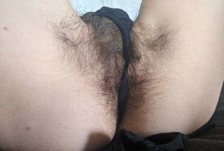 Hairy Women