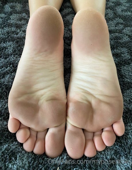 Myposedtoes