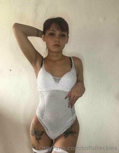 Sofisfreckles
