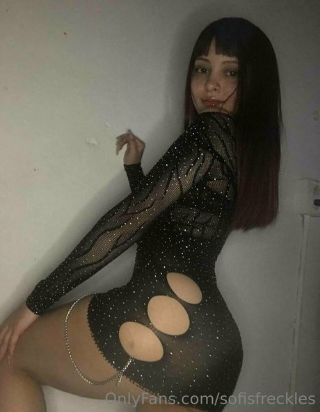 Sofisfreckles